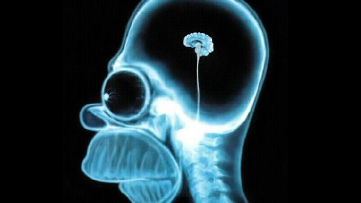homer brain scan